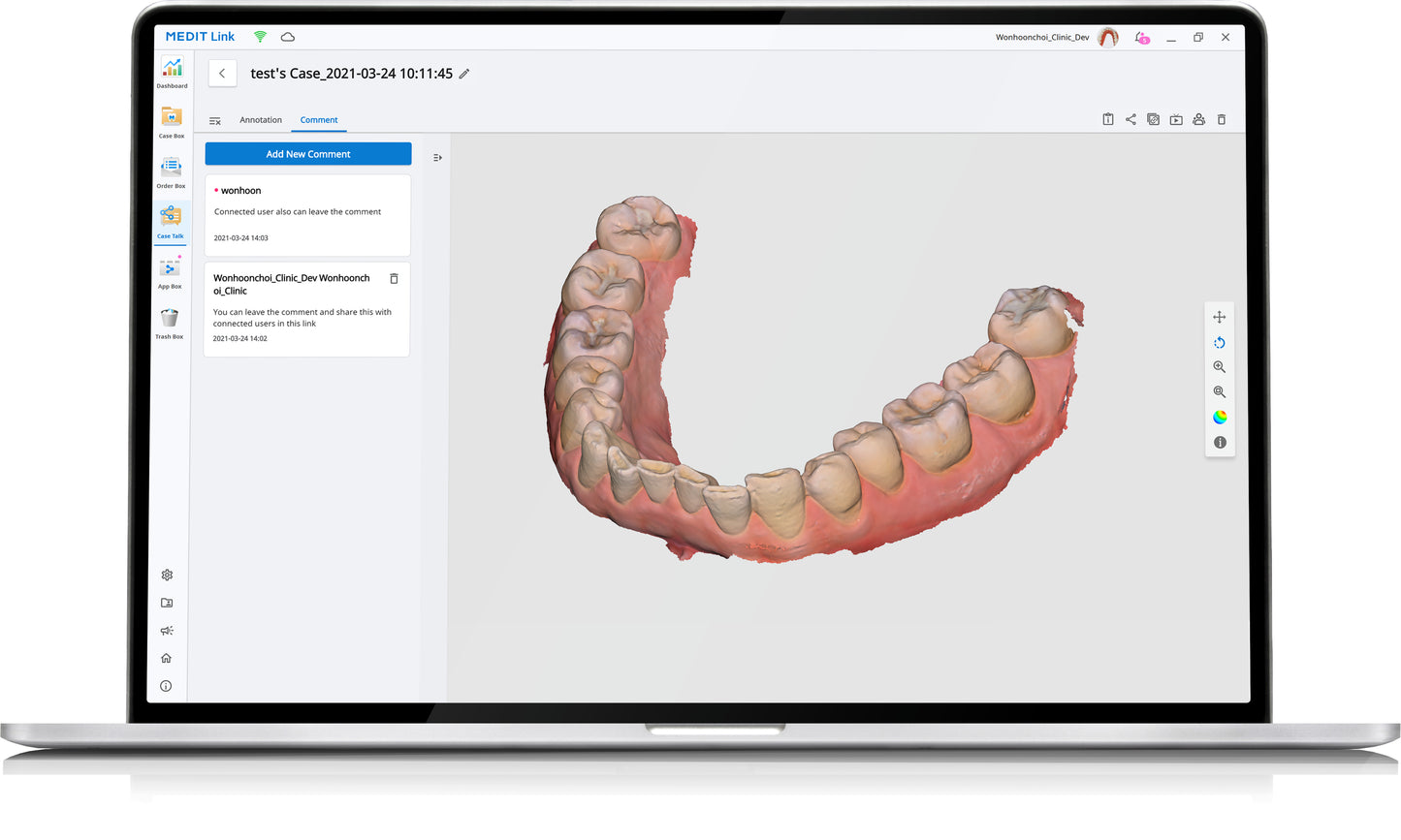 Medit i700w Intraoral Scanner